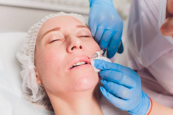De arts cosmetoloog maakt Lip augmentatie procedure van een mooie vrouw in een schoonheidssalon.. — Stockfoto
