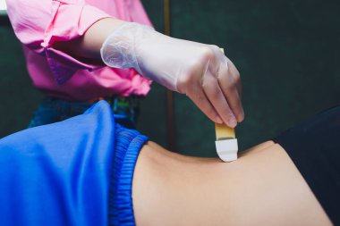 tüy dökümü ve güzellik konsepti - şeker yapıştırıcı veya balmumu saç için bal ahşap spatula çubuklarıyla kaldırma.