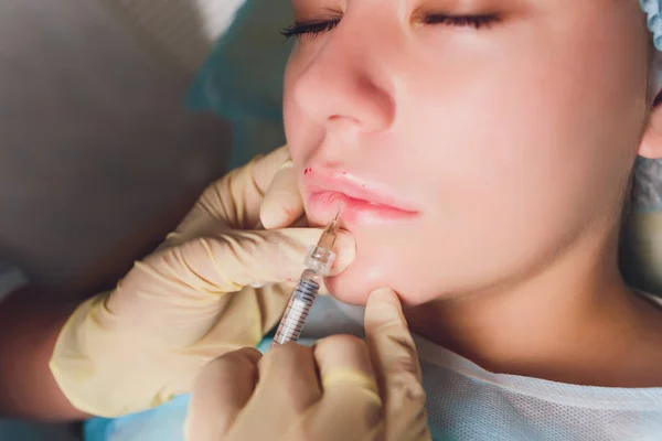 Lip Augmentation. Beautiful Young Womans Mouth Receiving Hyaluronic Acid Injection. Closeup Of Beautician Hands Doing Beauty Procedure To Sexy Female Lips. Cosmetology Treatment. High Resolution.