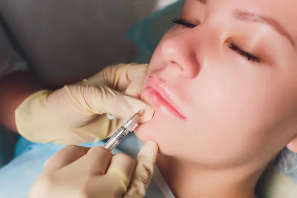 Lip augmentatie. Mooie jonge dames mond ontvangen hyaluronzuur injectie. Close-up van schoonheidsspecialiste handen doen Beauty procedure om sexy vrouwelijke lippen. Cosmetologie behandeling. Hoge resolutie. — Stockfoto