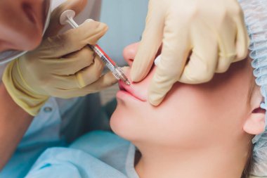 Dudak Büyütme. Güzel Genç Kadınlar Ağız Hyaluronik Asit Enjeksiyon alma. Seksi Kadın Dudakları için Güzellik Prosedürü Yapıyor Beautician Eller Closeup. Kozmetoloji Tedavisi. Yüksek Çözünürlük.