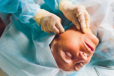 Mezothreads ve Thread Lifting, Kozmetoloji yapıyor yaşlı kadın. Yaşlanma belirtilerini ortadan kaldırmak için kozmetik prosedür. Güzellik Yüz, Yüz kontur, Yaş 70-80 yıl için plastik cerrahi kavramı.