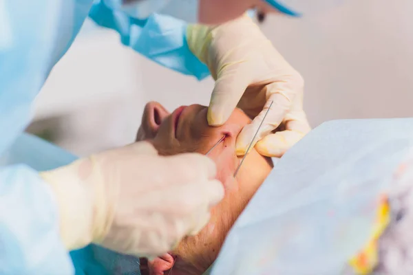 Leeftijd vrouw doet mesothreads en draad tillen, cosmetologie. Cosmetische procedure om tekenen van veroudering te elimineren. Beauty face, gezichtscontour, plastische chirurgie concept voor leeftijd 70-80 jaar. — Stockfoto