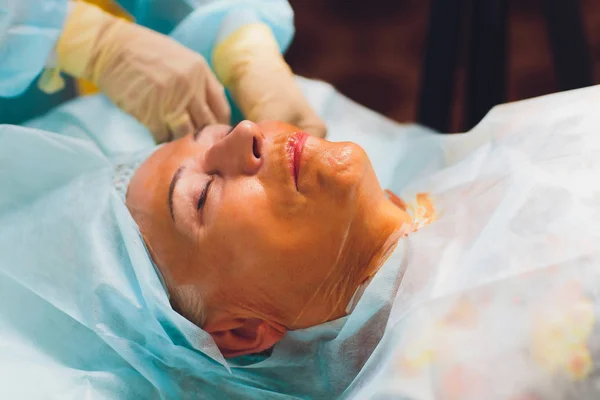 W wieku kobieta robi mezothreads i podnoszenie nici, Kosmetologia. Zabieg kosmetyczny, aby wyeliminować oznaki starzenia. Kosmetyczna twarz, kontur twarzy, koncepcja chirurgii plastycznej dla wieku 70-80 lat. — Zdjęcie stockowe