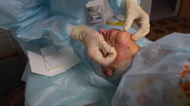 Mujer anciana haciendo mesothreads y Thread Lifting, Cosmetología. Procedimiento cosmético para eliminar los signos de envejecimiento. Belleza facial, contorno facial, concepto de cirugía plástica para la edad de 70-80 años . — Vídeo de stock