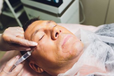 Yüz germe işleminin yakın çekimPdo Dikiş ameliyatı, yüz germe ameliyatı. Yeni iplik kaldırma yenilikçi tekniği, Novathreads ve Siluet Instalift erkek çanta göz altında.