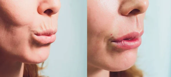 Primo piano di una mano che infila belle donne il labbro superiore . — Foto Stock