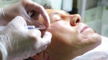 Güzellik enjeksiyonları ile kellik tedavisi. Eldivenli kozmetolojist elleri deri altı enjeksiyonuyguluyor. Plasmalifting erkek hasta.