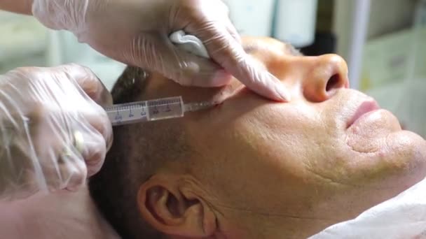 Behandeling van kaalheid met Beauty injecties. Cosmetoloog handen in handschoenen maken een subcutane injectie. Plasmalifting mannelijke patiënt. — Stockvideo