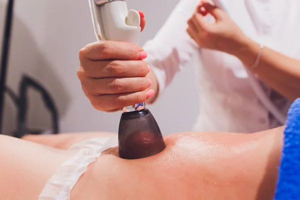 Anti cellulitis ingeblikte cosmetoloog massage op de probleemgebieden van het lichaam voor harmonie. De masseur cosmetoloog leidt vacuüm bekers over het lichaam in de buik en taille zones om de figuur te corrigeren — Stockfoto