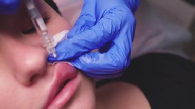 Genç bir kadın dudaklarına iğne vuruluyor, kapatın..