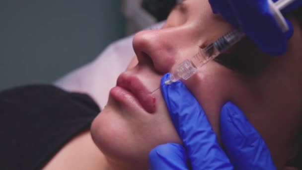 Jonge vrouw die een injectie in haar lippen krijgt, close up. — Stockvideo