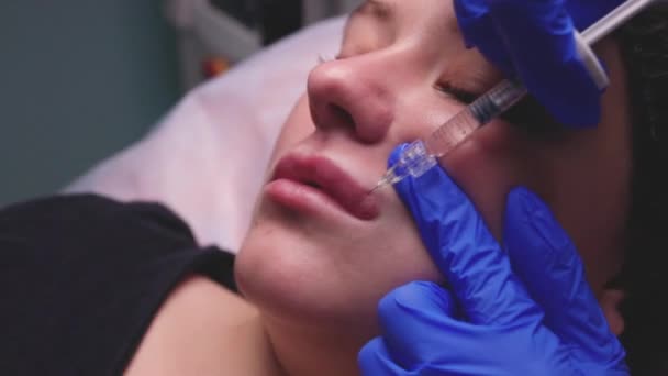 Jonge vrouw die een injectie in haar lippen krijgt, close up. — Stockvideo