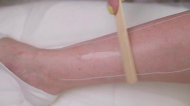 Güzellik Uzmanı Kalçadaki Kadına Epilasyon Lazeri Tedavisi Veriyor.