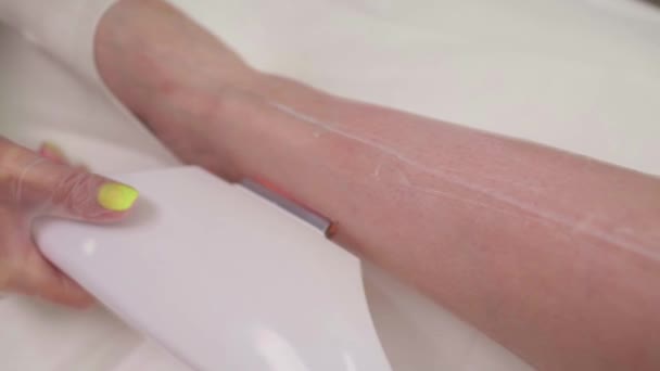 Laserové odstranění chlupů na dámských nohou. Úmyslná mělká hloubka pole. — Stock video