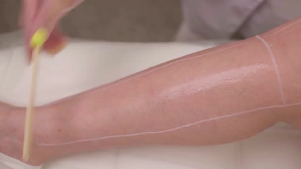 Beautist ger Epilation Laser behandling till kvinna på lår. — Stockvideo
