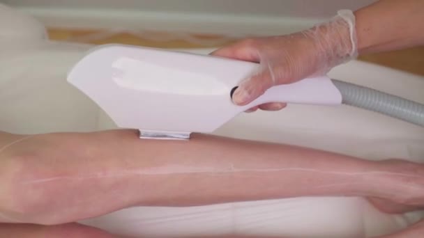 Épilation laser sur les jambes des femmes. Faible profondeur de champ intentionnelle. — Video