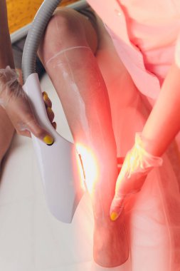 Bayanların bacaklarında lazer tüyü alındı. Bilinçli sığ alan derinliği.