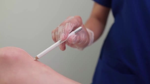 Beautist ger Epilation Laser behandling till kvinna på lår. — Stockvideo