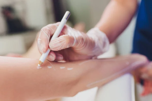 Esteticista dando tratamiento láser de acumulación a la mujer en el muslo . — Foto de Stock