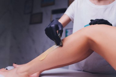 Şekerleme: bacaklarda sıvı şeker ile sonlanma.