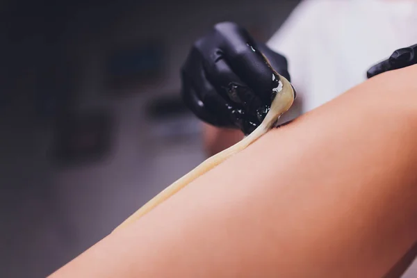 Zucker: Epilation mit Laktosezucker an den Beinen. — Stockfoto