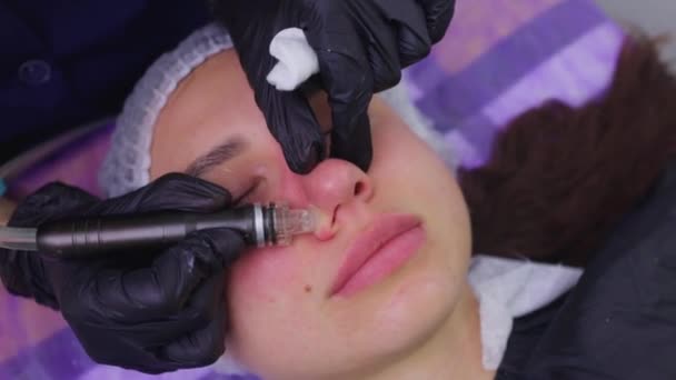 Donna che pulisce i pori della pelle del naso usando aspirapolvere, procedura cosmetica. — Video Stock