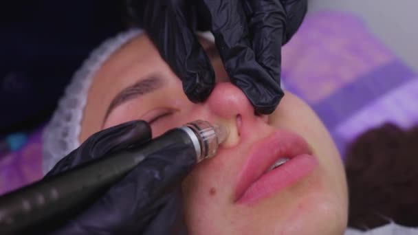 Donna che pulisce i pori della pelle del naso usando aspirapolvere, procedura cosmetica. — Video Stock