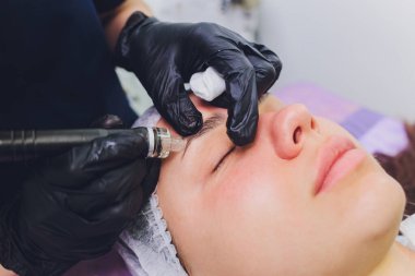 Cilt bakımı yapan kızların alnına. Enstrümantal kozmetoloji. Spa mı? Yüz tazeleme. Mekanik kabuk soyma.