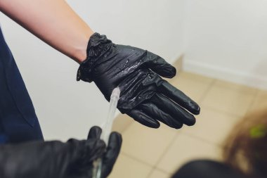 Gaz sıvısı saç soyma, kepek temizleme. Genç kadın..