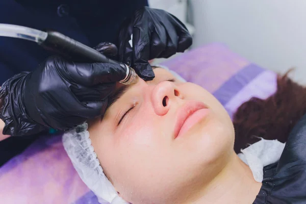 Dermabrasion girls forehead. Instrumental cosmetology. Spa. Facial Rejuvenation. Mechanical peeling skin. — Stock Photo, Image