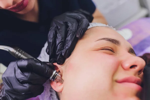 Mulher limpeza de poros de pele do nariz usando removedor blackhead vácuo, procedimento cosmético. — Fotografia de Stock