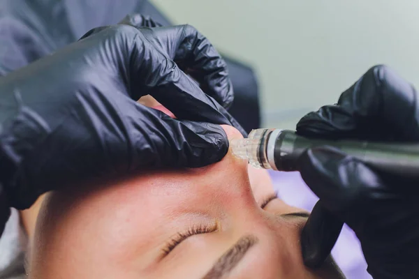 Женщина очищает поры кожи носа с помощью вакуумного удаления угрей, косметическая процедура. — стоковое фото