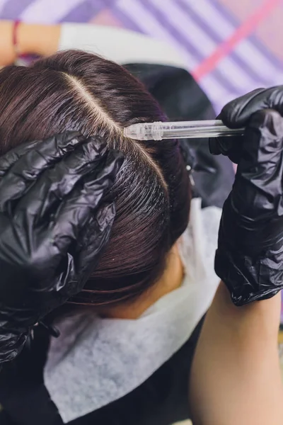 Gas-flüssiges Haarpeeling, Schuppenreinigung. junge Frau. — Stockfoto