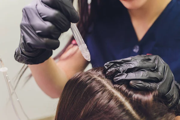 Gas-flüssiges Haarpeeling, Schuppenreinigung. junge Frau. — Stockfoto