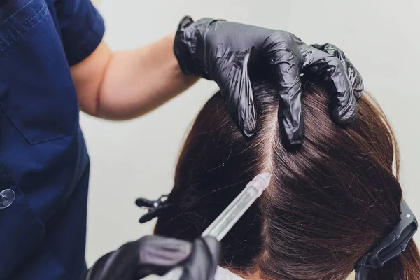 Gas-flüssiges Haarpeeling, Schuppenreinigung. junge Frau. — Stockfoto