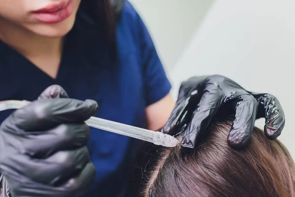 Peeling gas-liquido per capelli, detergente per forfora. giovane donna. — Foto Stock