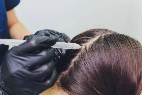 Pelar el cabello con líquido gaseoso, limpiar la caspa. mujer joven . — Foto de Stock