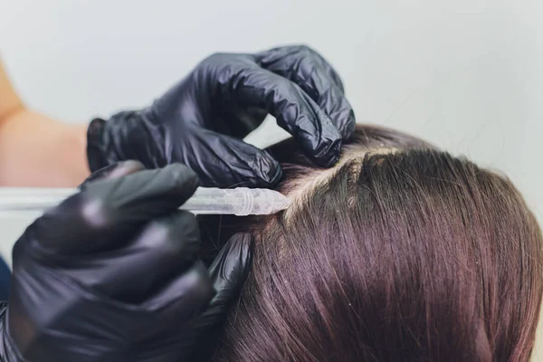 Gas-flüssiges Haarpeeling, Schuppenreinigung. junge Frau. — Stockfoto