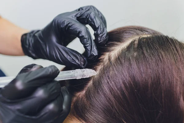 Gas-liquid hair peeling, dandruff cleansing. young woman. — Stock Photo, Image