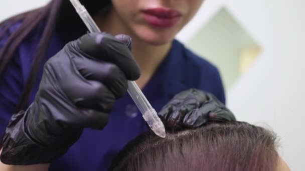 Peeling gas-liquido per capelli, detergente per forfora. giovane donna. — Video Stock