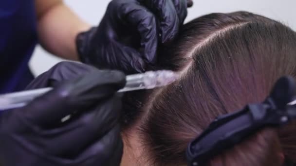 Peeling włosów w płynie gazowym, oczyszczanie łupieżu. młoda kobieta. — Wideo stockowe