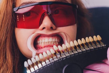 Diş hekimi hastaların diş gölgesiyle beyazlatma tedavisini karşılaştırıyor..