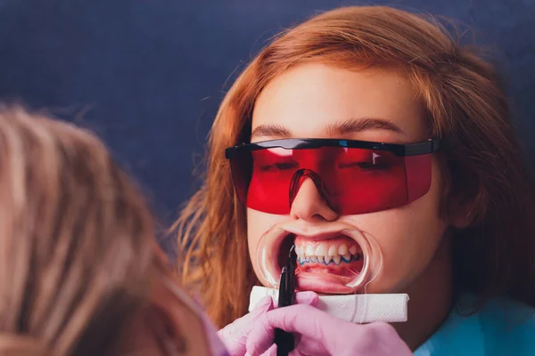 Close-up portret van een vrouwelijke patiënt bezoeken tandarts voor het bleken van tanden in kliniek, Teeth whitening procedure. — Stockfoto