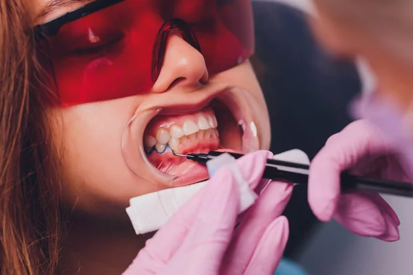 O dentista comparando pacientes sombra de dentes com amostras para o tratamento de branqueamento. — Fotografia de Stock