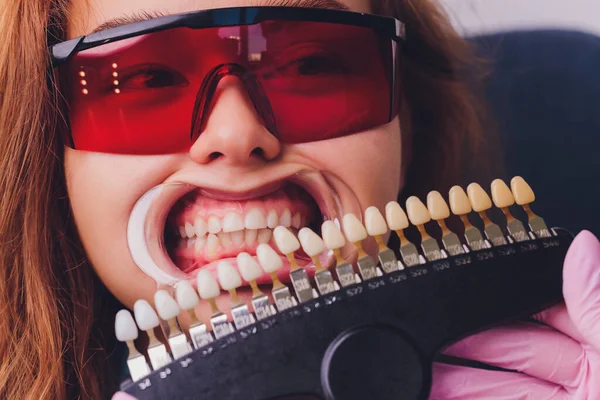 De tandarts vergelijkt patiënten tanden schaduw met monsters voor bleken behandeling. — Stockfoto
