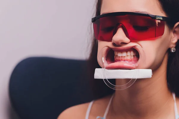 Il dentista confronta l'ombra dei denti dei pazienti con i campioni per il trattamento dello sbiancamento. — Foto Stock