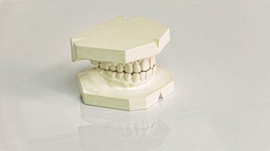 Protez atmalarını. Modern Diş Kliniği