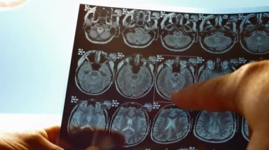 Doktor beyin x-ray ile görünüyor. Anlık görüntüsünü Mr kafa.