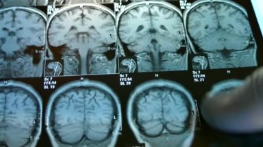 Doktor beyin x-ray ile görünüyor. Anlık görüntüsünü Mr kafa.